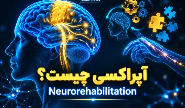 روش درمان آپراکسی گفتار